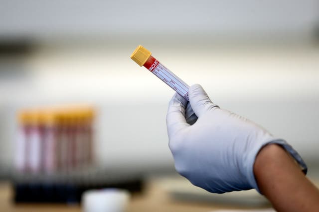 <p>The study includes samples taken 15 to 20 years ago </p>