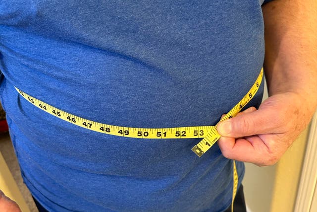 Obesity Definition